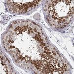 DDX25 Antibody in Immunohistochemistry (IHC)