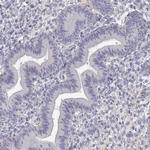 DDX25 Antibody in Immunohistochemistry (IHC)