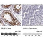 DDX25 Antibody