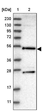 DDX25 Antibody in Western Blot (WB)