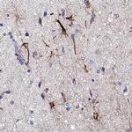DDX25 Antibody in Immunohistochemistry (IHC)