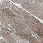 SVIL Antibody in Immunohistochemistry (IHC)