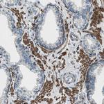 SVIL Antibody in Immunohistochemistry (IHC)