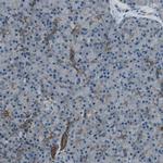 SVIL Antibody in Immunohistochemistry (IHC)