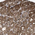 KIF12 Antibody in Immunohistochemistry (Paraffin) (IHC (P))