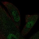 KIF12 Polyclonal Antibody