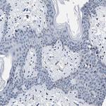 CaV1.3 Polyclonal Antibody