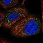 PEX1 Antibody in Immunocytochemistry (ICC/IF)