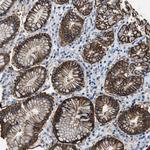 MUPP1 Polyclonal Antibody