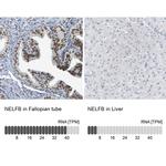COBRA1 Antibody in Immunohistochemistry (IHC)