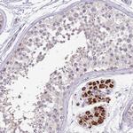 ZNF746 Antibody in Immunohistochemistry (Paraffin) (IHC (P))