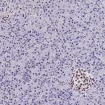 BCL9 Antibody in Immunohistochemistry (Paraffin) (IHC (P))