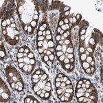 SLIRP Antibody in Immunohistochemistry (Paraffin) (IHC (P))