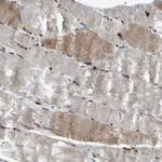 SLIRP Antibody in Immunohistochemistry (Paraffin) (IHC (P))