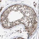 SLIRP Antibody in Immunohistochemistry (Paraffin) (IHC (P))