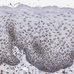 COG5 Antibody in Immunohistochemistry (Paraffin) (IHC (P))