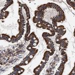 COG5 Antibody in Immunohistochemistry (Paraffin) (IHC (P))