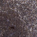 COG5 Antibody in Immunohistochemistry (Paraffin) (IHC (P))