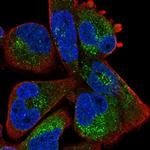 ZBTB39 Polyclonal Antibody