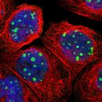 RRP1B Polyclonal Antibody