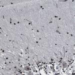 RRP1B Antibody in Immunohistochemistry (Paraffin) (IHC (P))