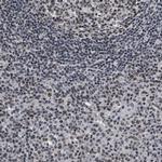 RRP1B Antibody in Immunohistochemistry (Paraffin) (IHC (P))