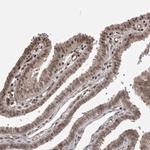 ZNF592 Polyclonal Antibody
