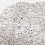 LARP6 Polyclonal Antibody