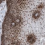 CWC27 Antibody in Immunohistochemistry (Paraffin) (IHC (P))