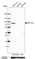 METT10D Antibody in Western Blot (WB)