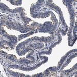 TSPAN33 Antibody in Immunohistochemistry (Paraffin) (IHC (P))