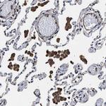 TSPAN33 Antibody in Immunohistochemistry (Paraffin) (IHC (P))
