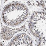 TSPAN33 Antibody in Immunohistochemistry (Paraffin) (IHC (P))