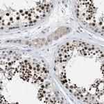 ZNF783 Antibody in Immunohistochemistry (IHC)