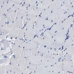 PSPH Antibody in Immunohistochemistry (Paraffin) (IHC (P))