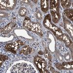 IDNK Antibody in Immunohistochemistry (IHC)