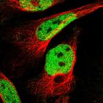 INIP Polyclonal Antibody