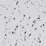 INIP Antibody in Immunohistochemistry (IHC)