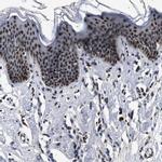 INIP Antibody in Immunohistochemistry (IHC)