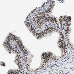 INIP Antibody in Immunohistochemistry (IHC)