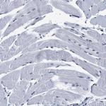 INIP Antibody in Immunohistochemistry (IHC)