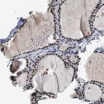 INIP Antibody in Immunohistochemistry (IHC)