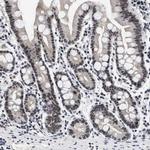 INIP Antibody in Immunohistochemistry (IHC)