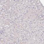 CIZ1 Antibody in Immunohistochemistry (Paraffin) (IHC (P))