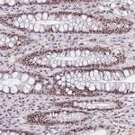 CIZ1 Antibody in Immunohistochemistry (Paraffin) (IHC (P))