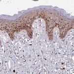 CIZ1 Antibody in Immunohistochemistry (Paraffin) (IHC (P))