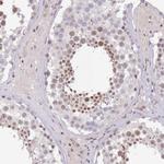 CIZ1 Antibody in Immunohistochemistry (Paraffin) (IHC (P))