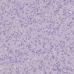 Calpain 9 Antibody in Immunohistochemistry (Paraffin) (IHC (P))