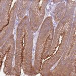 Calpain 9 Antibody in Immunohistochemistry (Paraffin) (IHC (P))