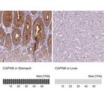 Calpain 9 Antibody in Immunohistochemistry (IHC)